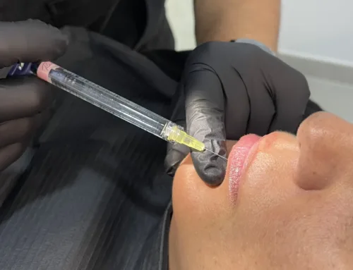 Estética Facial