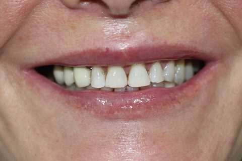 esther despues 1 480x320 1