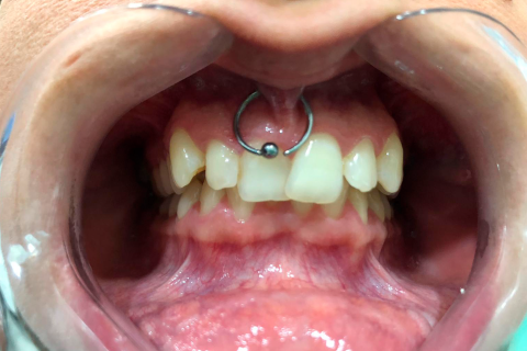 lourdes antes 480x320 1