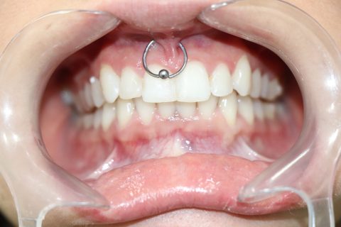 lourdes despues 480x320 1