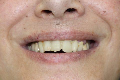 m jose antes 480x320 1