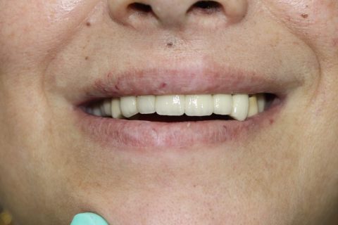 m jose despues 480x320 1