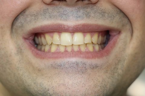 rafa antes 480x320 1